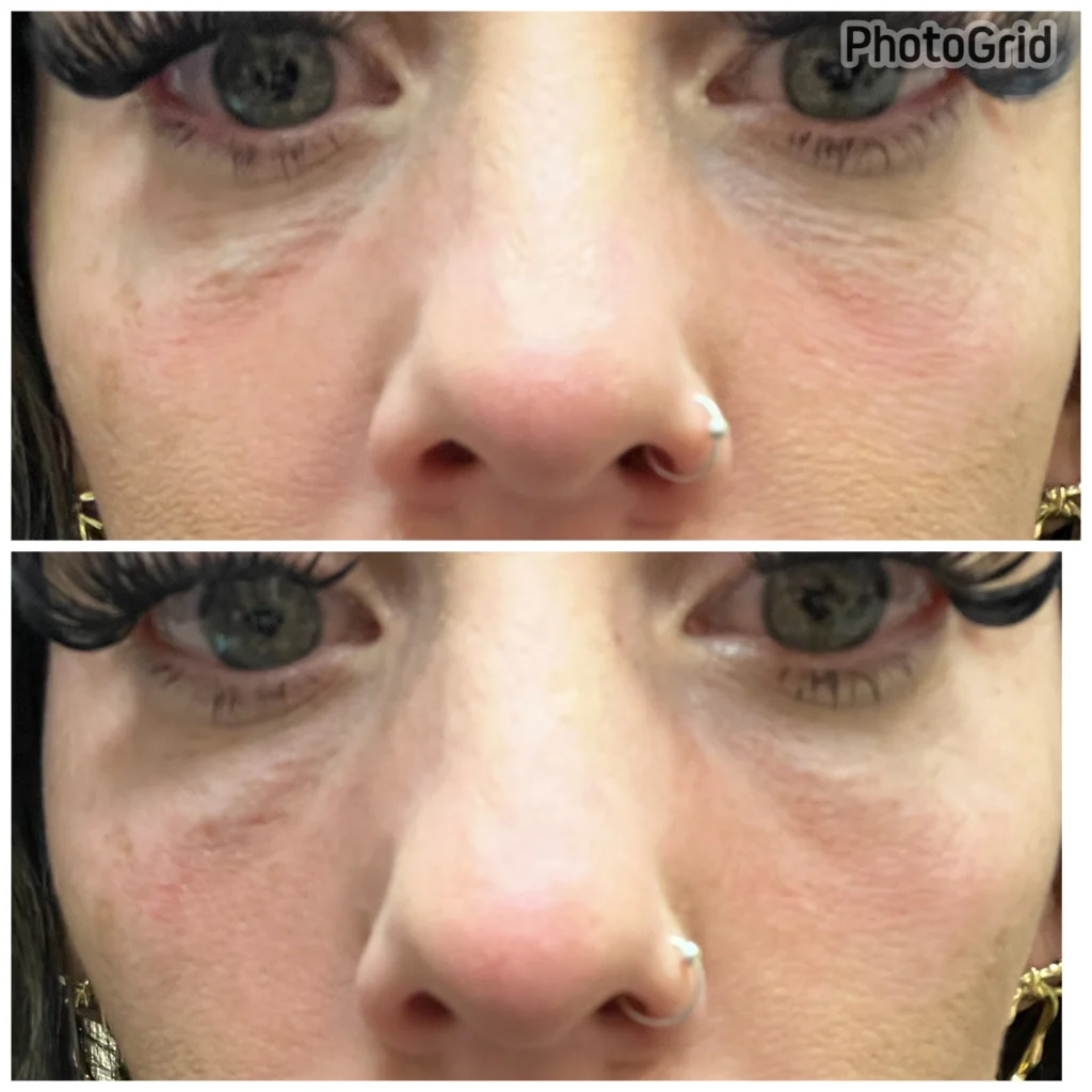 BTL EXION Treatment Near Me